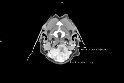 CT diagnostika nádorů hlavy a krku | Veterinární klinika Medipet Zlín
